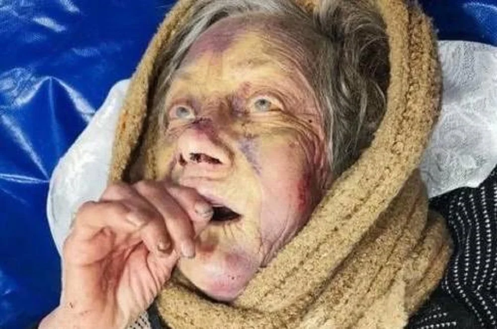 Зверски избитая внуком в Ростове 89-летняя бабушка умерла в муках в больнице