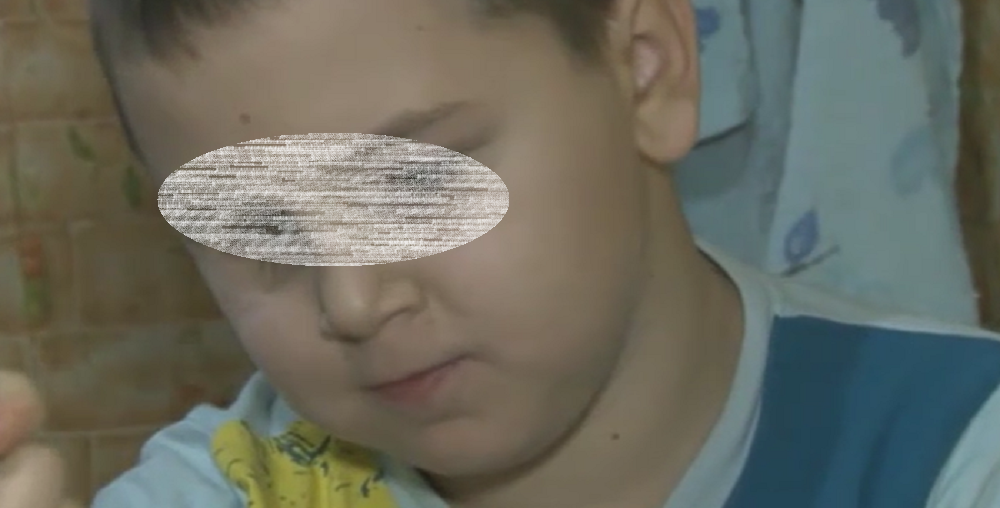 Следователи проверят ростовских врачей, не признающих мальчика без глаза инвалидом