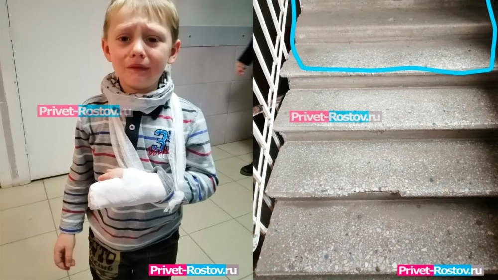 Ребенок получил несколько переломов, придя на прием в детскую поликлинику в Ростове