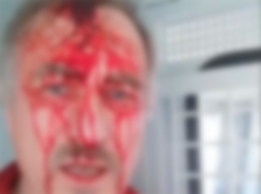 В Ростовской области мужчина пожаловался на кровавое избиение полицейскими