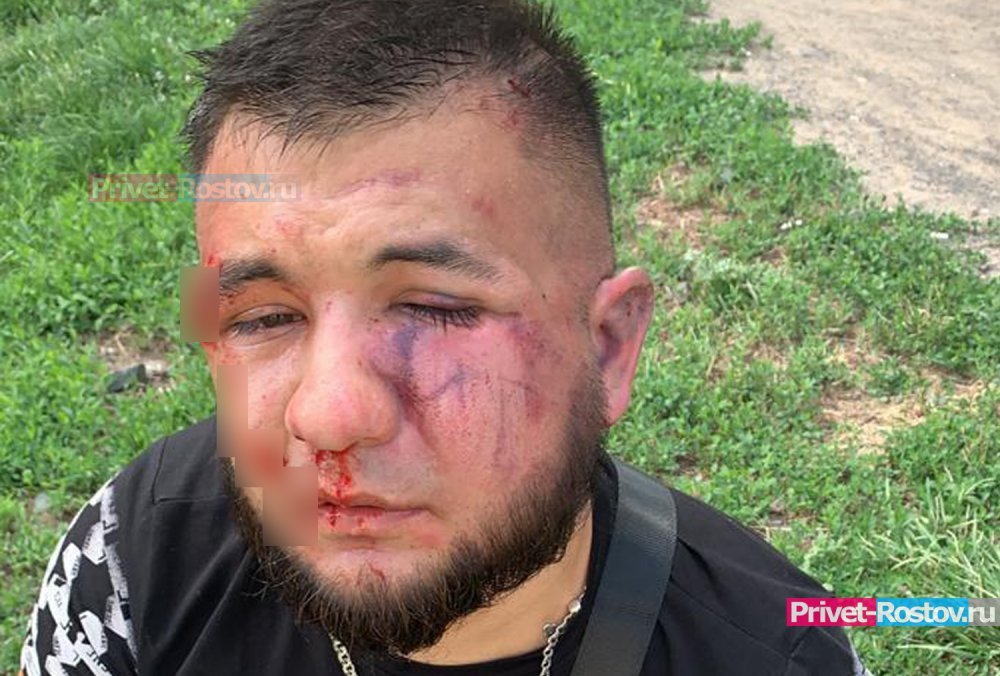 Автобетмен Гаспар Авакян нашел людей, сломавших ему челюсть