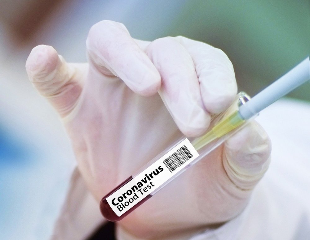 Стало известно, как добровольцы перенесли испытания второй российской вакцины от COVID-19