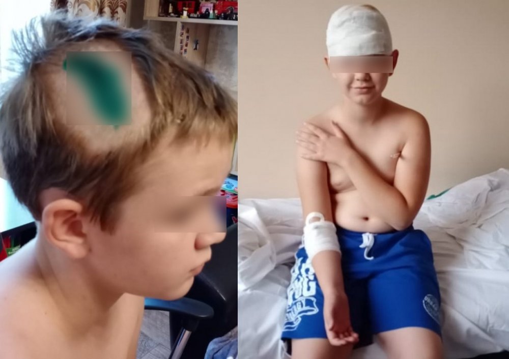 «Дошло до угроз жизни»: пятиклассник в Ростове отказался ходить в школу
