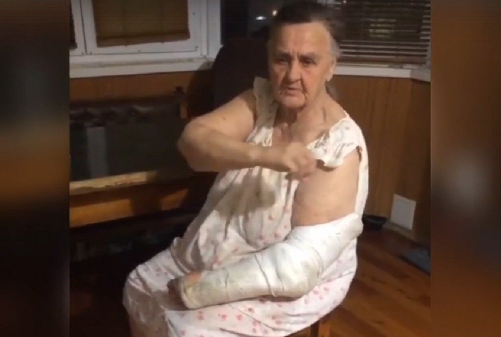 Избитую под Ростовую бабушку приютили неравнодушные люди, но им нужна помощь