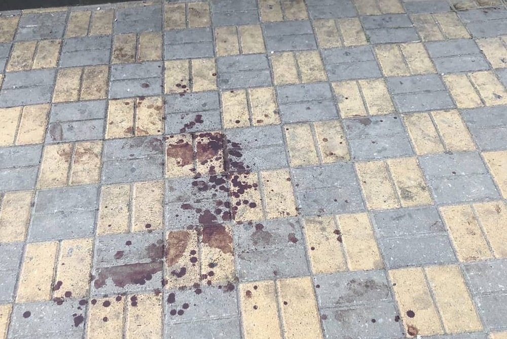 Кровавые следы рядом с администрацией Ворошиловского района до мурашек напугали ростовчан