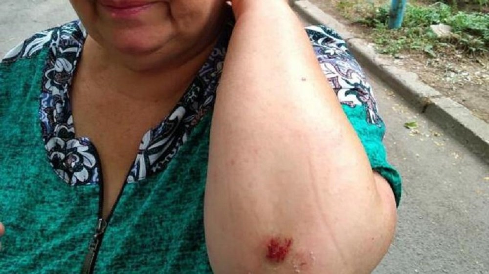 В Ростове ветка дерева упала и травмировала женщину