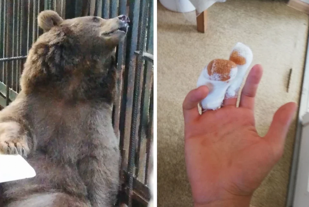 Подростку из Ростова в Абхазии медведица откусила палец