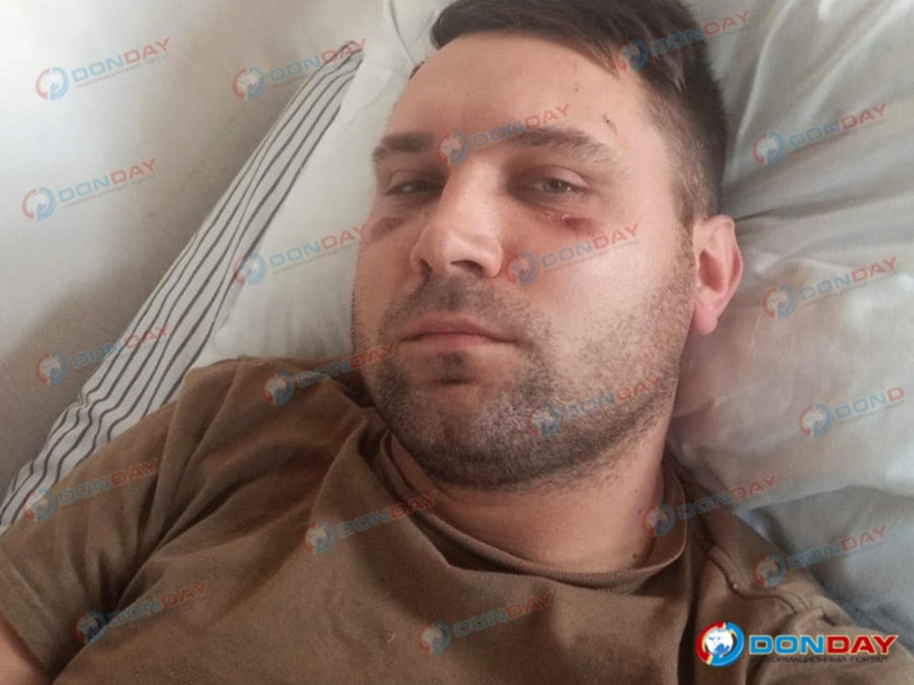 В Ростовской области на службу призвали мужчину с кистой мозга