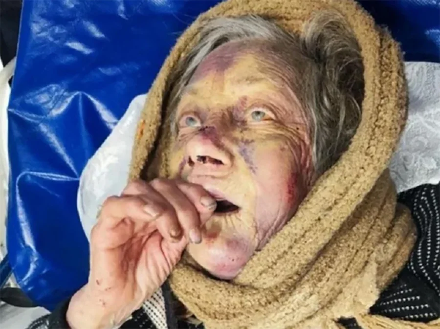 «Я убью тебя, старая крыса»: в Ростове проломил челюсть и ребра своей 89-летней бабушке