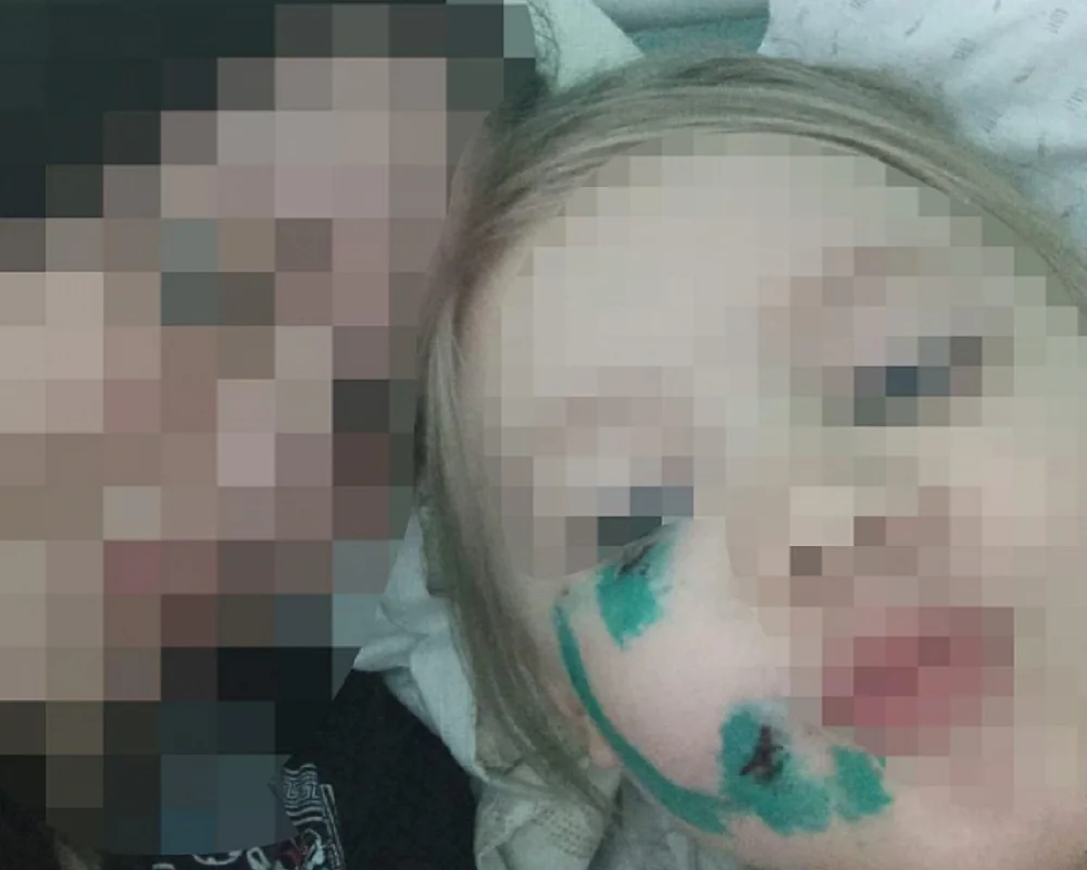 Мать искусанного собакой ребенка под Ростовом пожаловалась на травлю