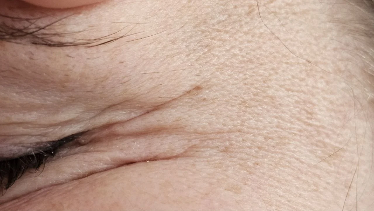 Сахар ускоряет старение кожи: нутрициолог объяснила, как сладости губят молодость