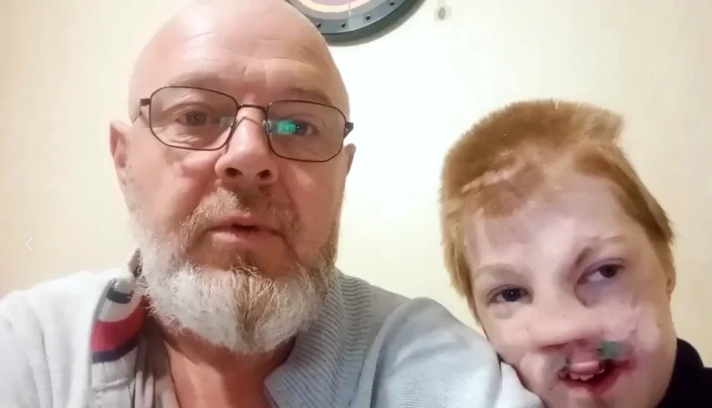 В Сочи суд взыскал 15 млн рублей за тяжёлые травмы лица ребёнка после нападения собак